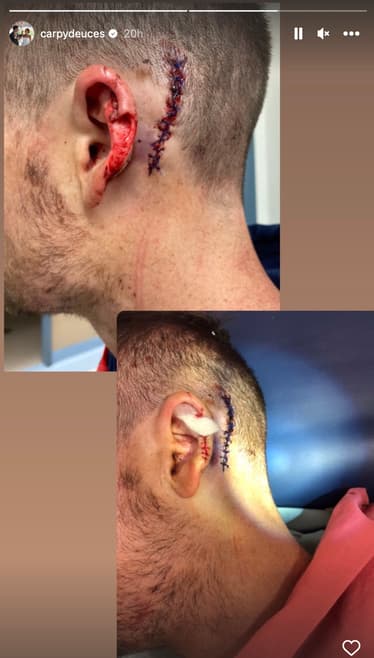 Ryan Carpenter cut